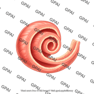 Swiss roll intestine duodenum