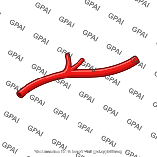 Artery branch