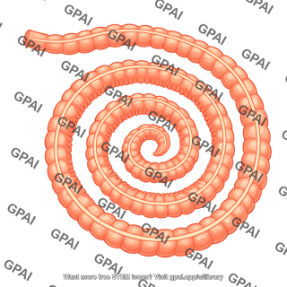 Swiss roll intestine