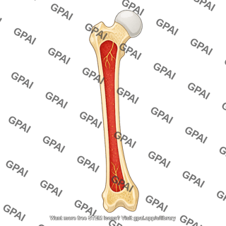 Femur anterior cut