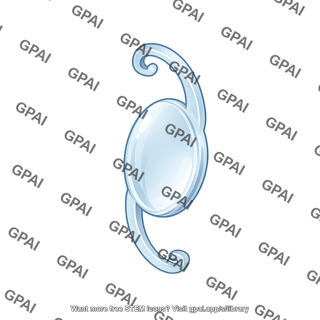 Eye lens prosthetic