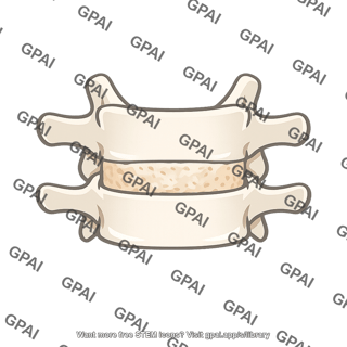 Vertebrae with intervertebral disc
