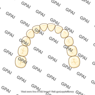 Dentition primary upper schematic teeth only