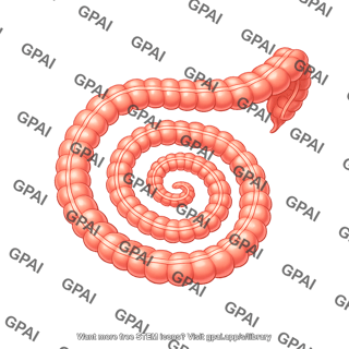 Swiss roll intestine colon