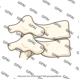 Cervical facet joint