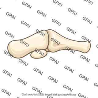 Sesamoid bone hallux lateral