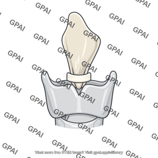 Thyroepiglottic ligament