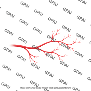 Branching vessel