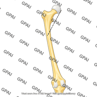 Femur anterior coxa valga with neck angle