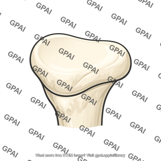 Medial condyle of tibia