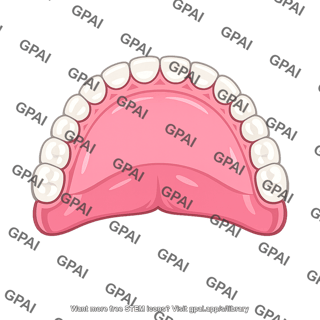 Upper dentures