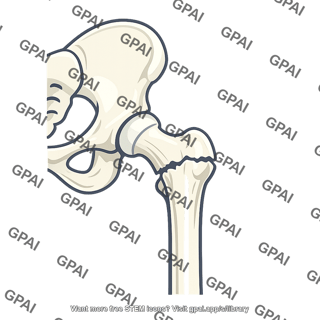 Hip fractured