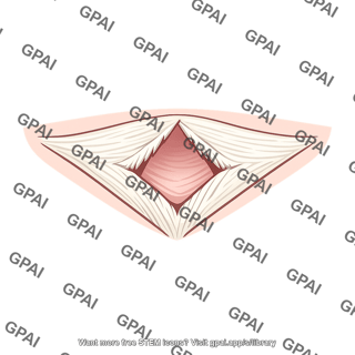 Inguinal ring superficial