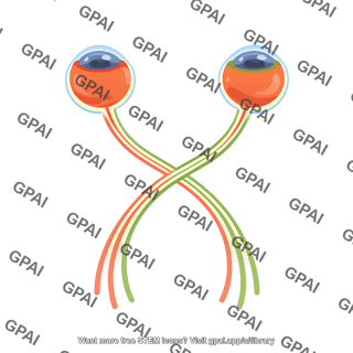 Optic chiasm tracts