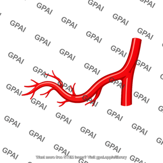 Anterior inferior cerebellar artery