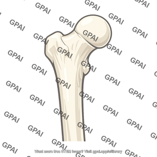 Proximal femur