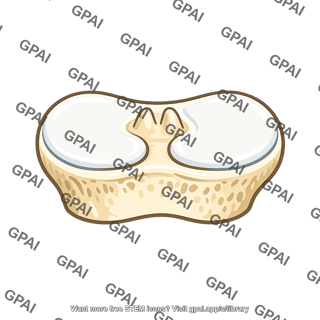Tibial plateau