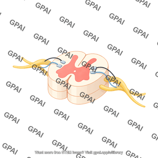 Spinal cord cross section with nerve roots and stimulation leads