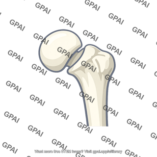 Femoral head