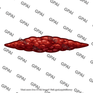 Elongated thrombus
