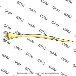 Olfactory nerve bundle variant