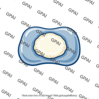 Wrist bone ossifying
