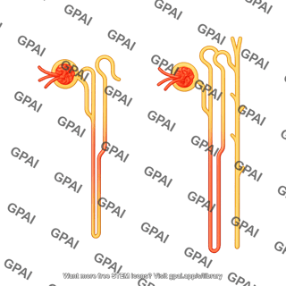 Nephron cortical juxtamedullary