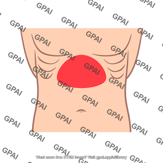 Epigastrium