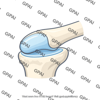 Condylar joint