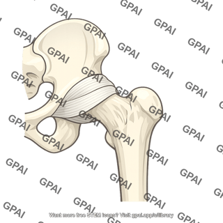 Ischiofemoral ligament