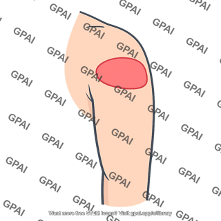 Upper lateral arm region