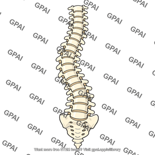 Scoliosis