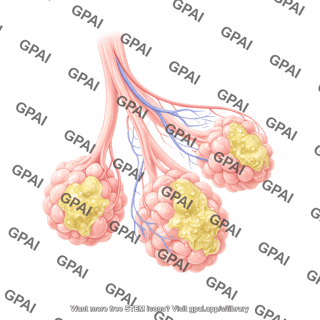 Alveoli with mucous