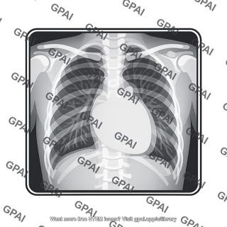 Chest radiograph anteroposterior