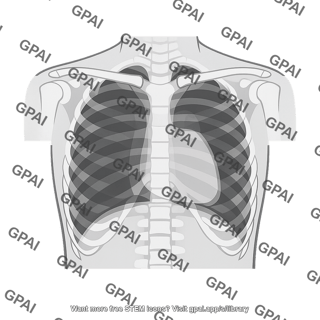 Chest radiograph posteroanterior