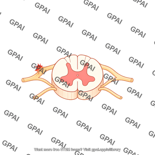 Spinal cord cross section dorsal root avulsion