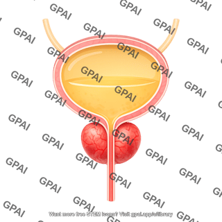 Bladder male full prostatitis 660