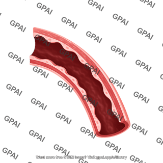 Blood vessel curved dark