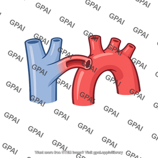 Ductus arteriosus patent