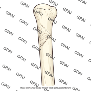 Deltoid tuberosity