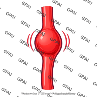 Popliteal artery aneurysm pulsatile