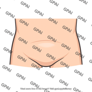 Suprapubic region