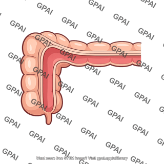 Hepatic flexure