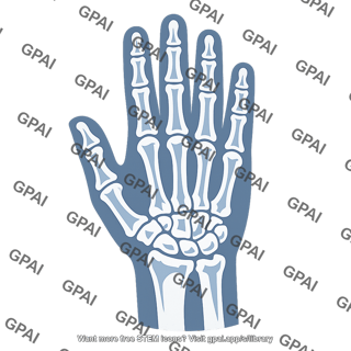 Hand xray