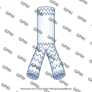 Endovascular graft
