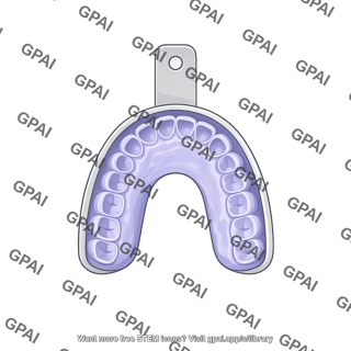 Dental impression upper arch