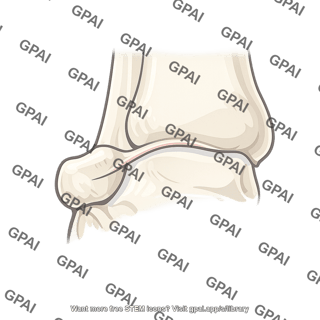 Posterior malleolar fold