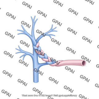 Portal vein inferior vena cava