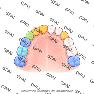 Dentition primary upper color coded