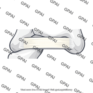 Stretching elastic band